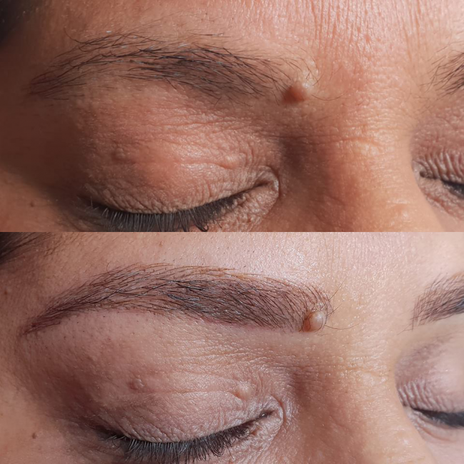 עיצוב גבות לפני ואחרי