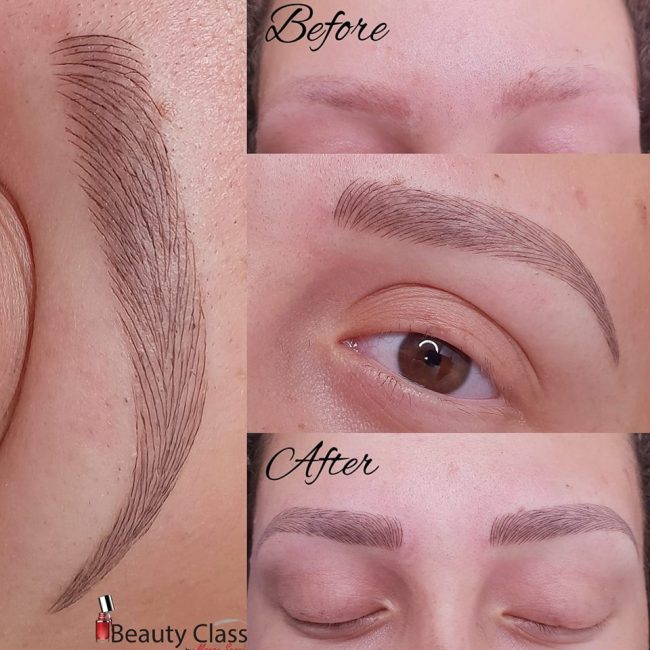 טריכוטלמניה