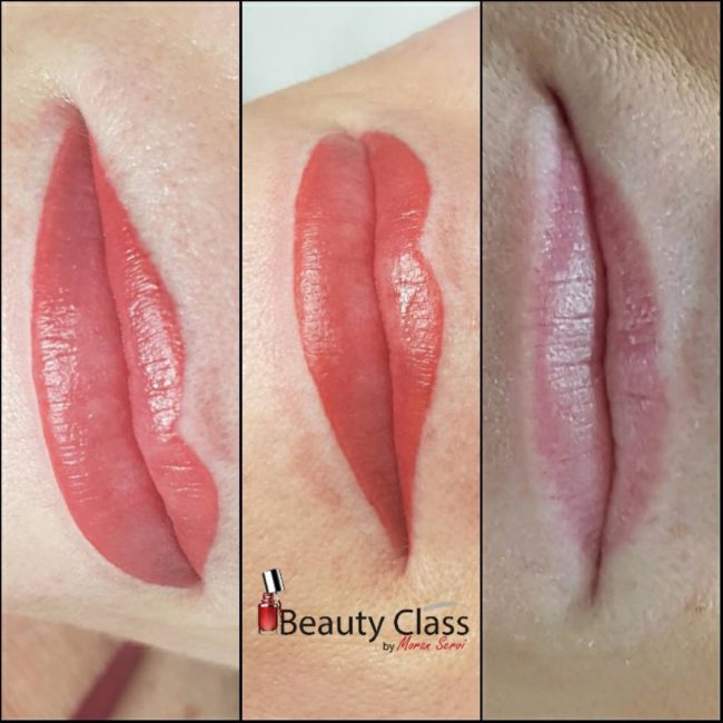 שפתיים לפניי ואחריי ביוטי קלאס