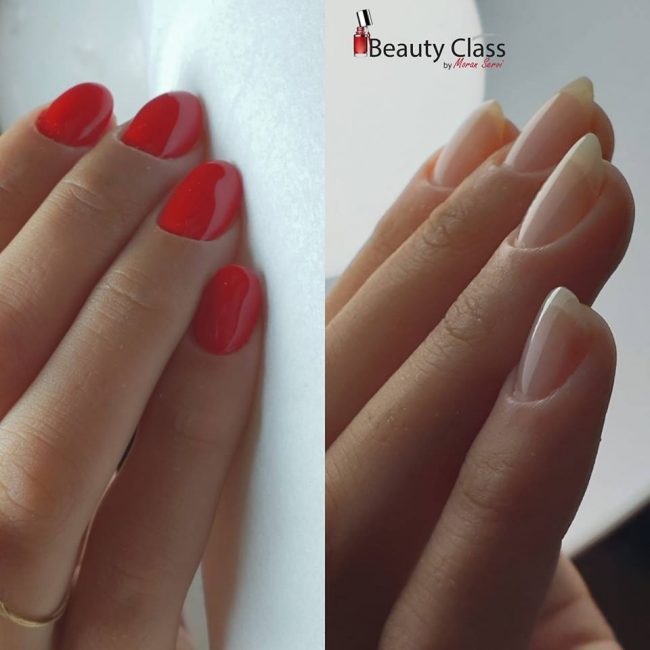 מבנה אנטומי ביוטי קלאס