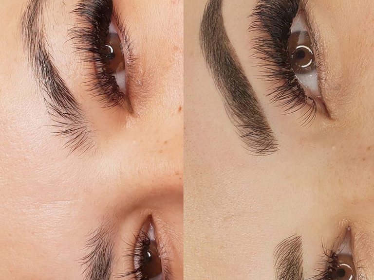 מיקרובליידינג