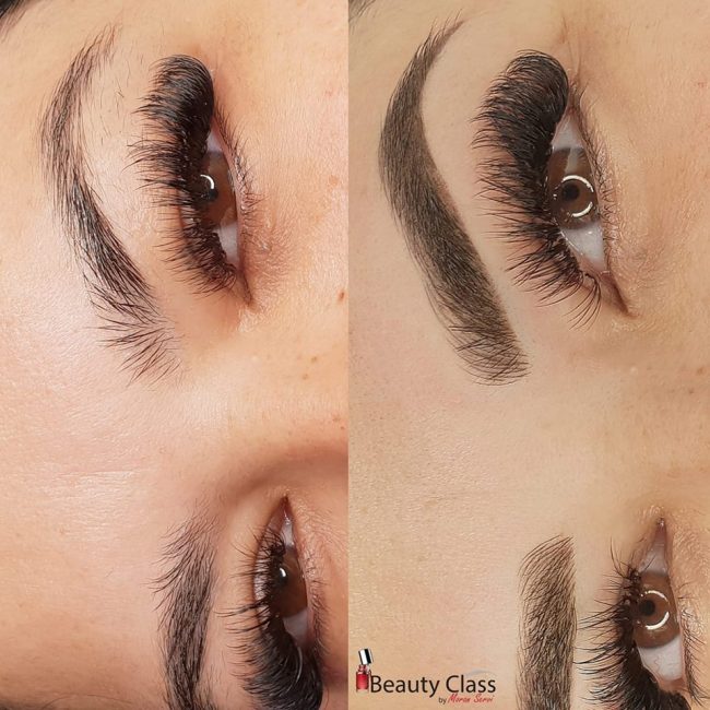 מיקרובליידינג