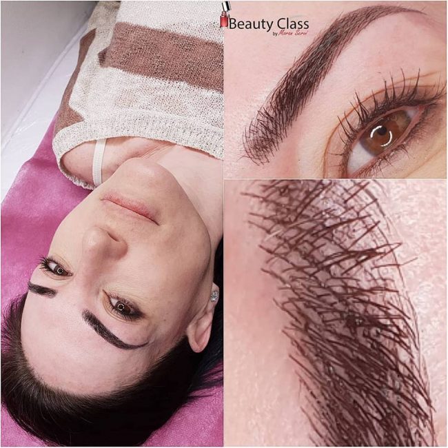 מיקרובליידינג