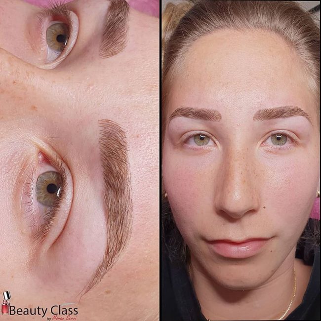 מיקרובליידינג