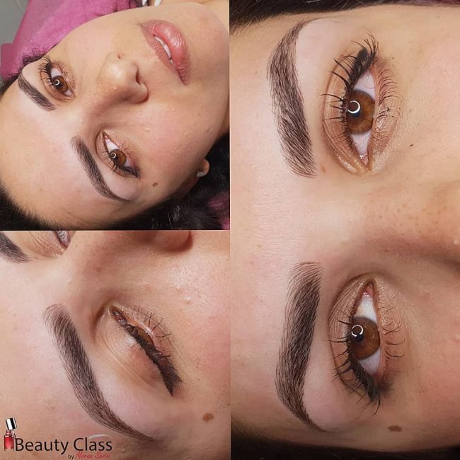 מיקרובליידינג