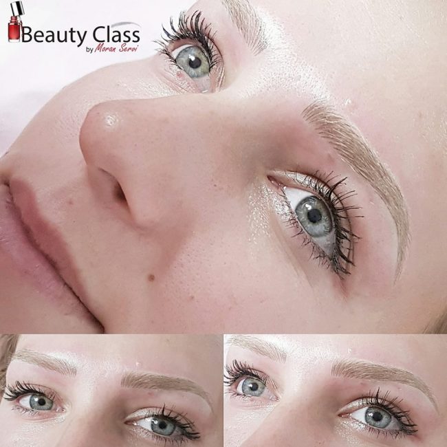 מיקרובליידינג